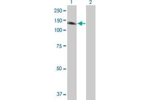 Western Blot analysis of PTK2B expression in transfected 293T cell line by PTK2B MaxPab polyclonal antibody. (PTK2B 抗体  (AA 1-1009))