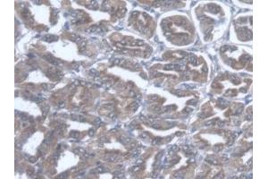 Detection of TST in Mouse Stomach Tissue using Polyclonal Antibody to Thiosulfate Sulfurtransferase (TST) (TST 抗体  (AA 2-297))