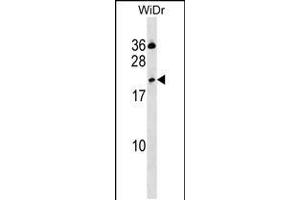 Western blot analysis in WiDr cell line lysates (35ug/lane). (CLEC2D 抗体  (AA 109-137))