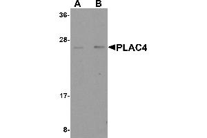 Western Blotting (WB) image for anti-Placenta-Specific 4 (PLAC4) (Middle Region) antibody (ABIN1031043) (PLAC4 抗体  (Middle Region))