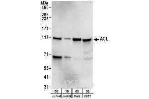 Western Blotting (WB) image for anti-ATP Citrate Lyase (ACLY) (AA 1051-1101) antibody (ABIN7452922) (ACLY 抗体  (AA 1051-1101))