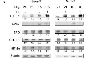 Bortezomib attenuates HIF-1 but not HIF-2 transcriptional activity. (EPAS1 抗体)