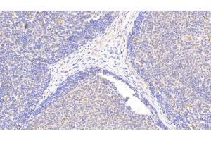Detection of IkBe in Human Lymph node Tissue using Polyclonal Antibody to Inhibitory Subunit Of NF Kappa B Epsilon (IkBe)