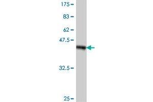 Western Blotting (WB) image for anti-Transient Receptor Potential Cation Channel, Subfamily C, Member 4 Associated Protein (TRPC4AP) (AA 341-451) antibody (ABIN565229)