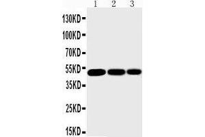 Anti-IKK gamma antibody, Western blotting Lane 1: Mouse Liver Tissue Lysate Lane 2: Mouse Brain Tissue Lysate Lane 3: Mouse Ovary Tissue Lysate (IKBKG 抗体  (N-Term))