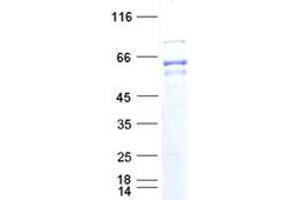 Validation with Western Blot (THRA Protein (DYKDDDDK Tag))