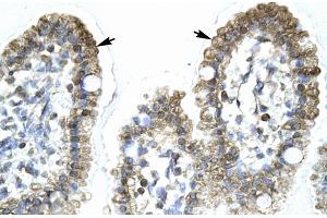 Rabbit Anti-MYCBP Antibody Catalog Number: ARP31860 Paraffin Embedded Tissue: Human Intestine Cellular Data: Epithelial cells of intestinal villas Antibody Concentration: 4. (MYCBP 抗体  (Middle Region))