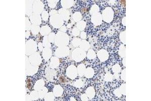 Immunohistochemical staining of human bone marrow with TAGLN2 polyclonal antibody  shows cytoplasmic positivity in bone marrow poietic cells at 1:200-1:500 dilution. (TAGLN2 抗体)