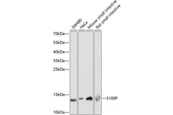 S100P 抗体