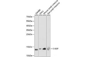 Western blot analysis of extracts of various cell lines using S100P Polyclonal Antibody at dilution of 1:1000. (S100P 抗体)