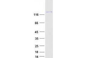 Validation with Western Blot