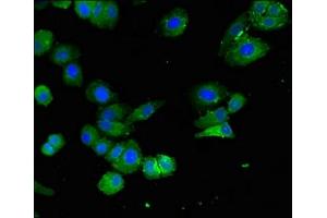 Immunofluorescent analysis of HepG2 cells using ABIN7151564 at dilution of 1:100 and Alexa Fluor 488-congugated AffiniPure Goat Anti-Rabbit IgG(H+L) (ELOVL4 抗体  (AA 270-314))