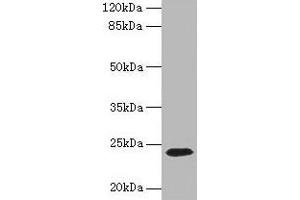Western blot All lanes: CD3E antibody at 1. (CD3 epsilon 抗体  (AA 23-207))