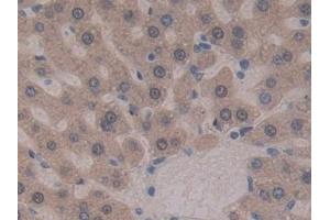 Detection of GSTt2 in Rat Liver Tissue using Polyclonal Antibody to Glutathione S Transferase Theta 2 (GSTt2) (GSTT2 抗体  (AA 16-242))
