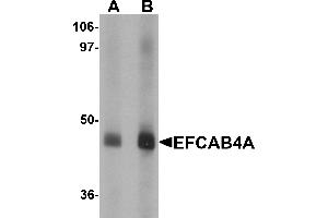 Western blot analysis of EFCAB4A in human lung tissue lysate with EFCAB4A antibody at (A) 1 and (B) 2 µg/mL. (EFCAB4A 抗体  (Middle Region))