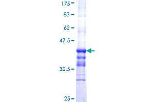 Image no. 1 for Apolipoprotein C-II (APOC2) (AA 23-101) protein (GST tag) (ABIN1345370) (Apolipoprotein C-II Protein (APOC2) (AA 23-101) (GST tag))