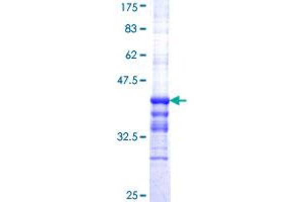 Apolipoprotein C-II Protein (APOC2) (AA 23-101) (GST tag)