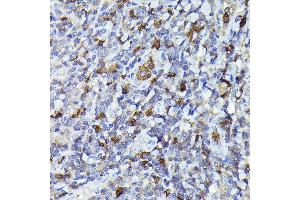 Immunohistochemistry of paraffin-embedded human tonsil using Smad2 Rabbit pAb (ABIN1513537, ABIN3020986, ABIN3020987 and ABIN1514681) at dilution of 1:100 (40x lens). (SMAD2 抗体)
