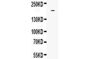 Western Blotting (WB) image for anti-ATP-Binding Cassette, Sub-Family C (CFTR/MRP), Member 4 (ABCC4) (AA 1-77) antibody (ABIN5518719)