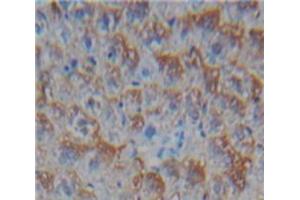 IHC-P analysis of Liver tissue, with DAB staining. (CD40 Ligand 抗体  (AA 180-261))