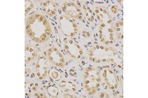 Immunohistochemistry of paraffin-embedded human kidney using PDHA1 antibody at dilution of 1:200 (x400 lens).