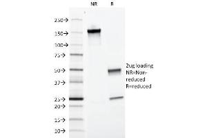 SDS-PAGE Analysis Purified EpCAM-Monospecific Mouse Monoclonal Antibody (EGP40/1372). (EpCAM 抗体  (Extracellular Domain))