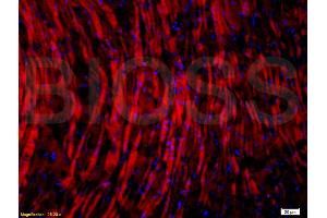 Formalin-fixed and paraffin embedded: rat brain tissue labeled with Anti-Glucocorticoid receptor(GR) Polyclonal Antibody, Unconjugated (ABIN726875) at 1:200,, followed by conjugation to the secondary antibody was Goat Anti-Rabbit IgG, PE conjugated at 1:200 for 40 minutes at 37°C (Glucocorticoid Receptor 抗体  (AA 231-320))