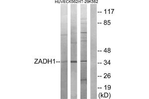 Western blot analysis of extracts from HUVEC cells, K562 cells and HT-29 cells, using ZADH1 antibody. (PTGR2 抗体  (Internal Region))