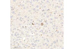 Immunohistochemistry of paraffin embedded mouse liver using RAB21 (ABIN7075341) at dilution of 1: 700 (300x lens) (RAB21 抗体)