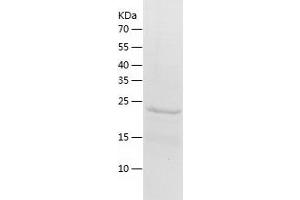 Western Blotting (WB) image for Proteasome (Prosome, Macropain) Activator Subunit 1 (PA28 Alpha) (PSME1) (AA 1-249) protein (His tag) (ABIN7286976) (PSME1 Protein (AA 1-249) (His tag))