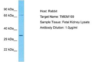 Host: Rabbit Target Name: TMEM169 Sample Type: Fetal Kidney lysates Antibody Dilution: 1. (TMEM169 抗体  (C-Term))