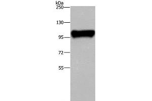 Western Blot analysis of Raji cell using PTK2B Polyclonal Antibody at dilution of 1:300 (PTK2B 抗体)