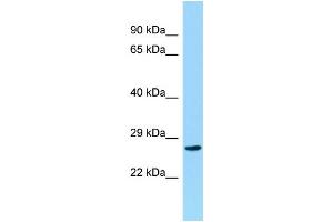 Host: Rabbit Target Name: CCDC28B Sample Type: Hela Whole cell lysates Antibody Dilution: 1. (CCDC28B 抗体  (C-Term))