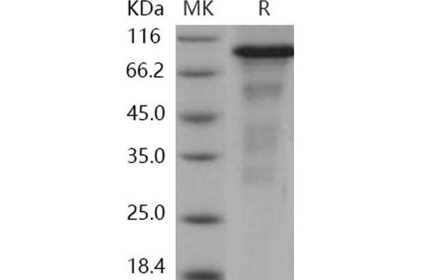 ERN1 Protein (AA 465-977) (GST tag,His tag)