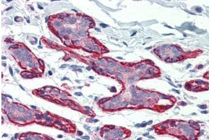 Human Breast (formalin-fixed, paraffin-embedded) stained with DLG4 antibody ABIN396947 at 5 ug/ml followed by biotinylated goat anti-rabbit IgG secondary antibody ABIN481713, alkaline phosphatase-streptavidin and chromogen. (DLG4 抗体  (C-Term))