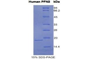 SDS-PAGE analysis of Human Profilin 2 Protein. (PFN2 蛋白)