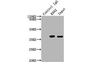 Immunoprecipitating CDK6 in K562 whole cell lysate Lane 1: Rabbit control IgG instead of ABIN7127420 in K562 whole cell lysate. (Recombinant CDK6 抗体)