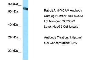 Western Blotting (WB) image for anti-Melanoma Cell Adhesion Molecule (MCAM) (Middle Region) antibody (ABIN2789518) (MCAM 抗体  (Middle Region))