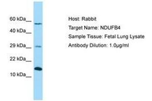 Image no. 1 for anti-NADH Dehydrogenase (Ubiquinone) 1 beta Subcomplex, 4, 15kDa (NDUFB4) (AA 71-120) antibody (ABIN6750060) (NDUFB4 抗体  (AA 71-120))