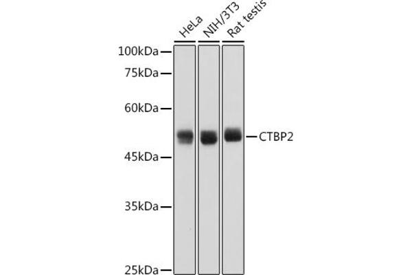 CTBP2 抗体