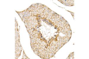 Immunohistochemistry of paraffin-embedded human liver using CD81 Rabbit pAb (ABIN6134776, ABIN6138231, ABIN6138232 and ABIN6220897) at dilution of 1:50 (40x lens). (CD81 抗体  (AA 1-100))