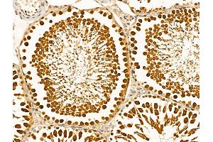 ABIN6261249 and ABIN6268912 at 1/100 staining Rat testis tissue by IHC-P. (DDR1 抗体  (C-Term))