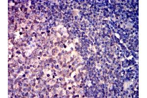 Immunohistochemical analysis of paraffin-embedded lymphoid tissues using CD267 mouse mAb with DAB staining.