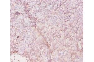 Immunohistochemistry of paraffin-embedded human tonsil tissue using ABIN7155601 at dilution of 1:20 (HLA-DRA 抗体  (AA 28-254))