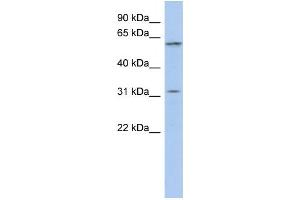 Western Blotting (WB) image for anti-Chromosome 1 Open Reading Frame 110 (C1ORF110) antibody (ABIN2459956)
