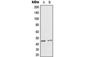 Western blot analysis of Cytokeratin 18 (pS33) expression in A431 (A), HeLa (B) whole cell lysates. (Cytokeratin 18 抗体  (N-Term, pSer33))