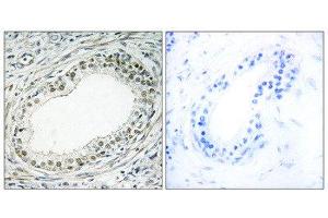 Immunohistochemistry (IHC) image for anti-Ribosomal Protein L36 (RPL36) (Internal Region) antibody (ABIN1850636) (RPL36 抗体  (Internal Region))
