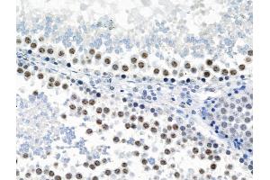 Phospho-JIP1 (Thr205) Antibody at 1/100 staining Rat testis tissue by IHC-P. (MAPK8IP1 抗体  (pThr205))