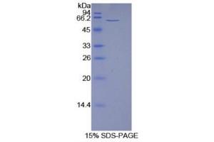SDS-PAGE (SDS) image for 5'-Nucleotidase, Ecto (CD73) (NT5E) protein (ABIN1078685) (CD73 蛋白)