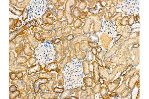 ABIN6260880 and ABIN6279304 at 1/100 staining Rat kidney tissue by IHC-P.
